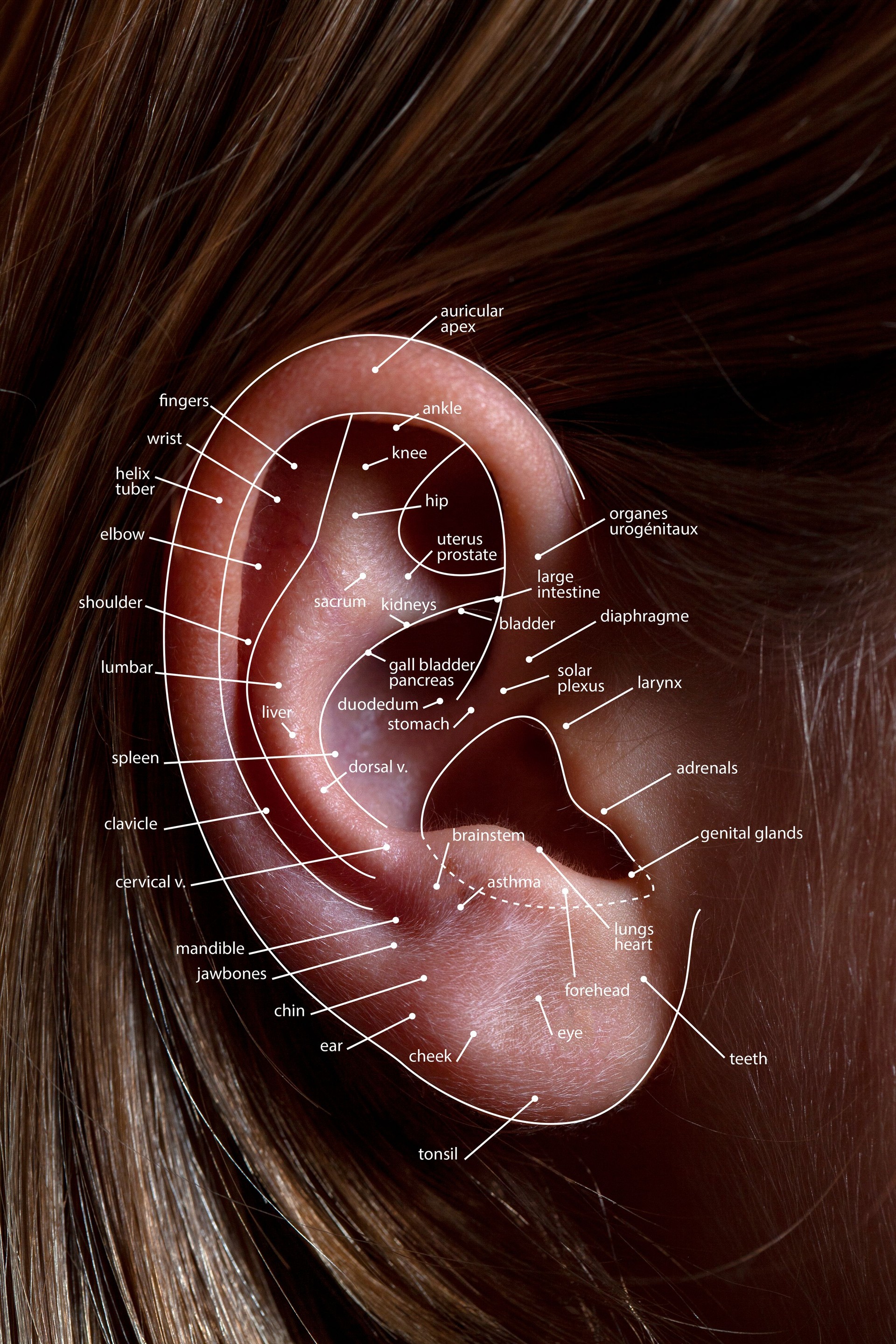 acupuncture et auriculothérapie
